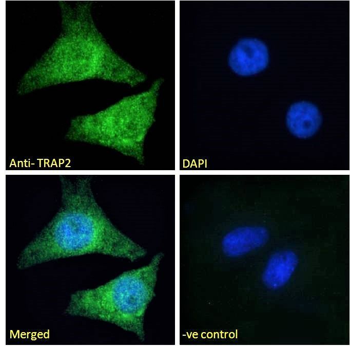 PSMD2 antibody