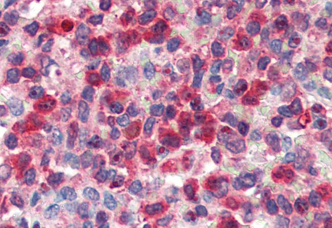 Goat anti-G6PD (aa 308 - 320) Antibody