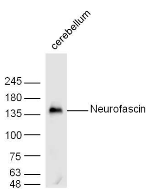 Neurofascin 155 antibody