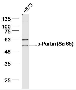 Parkin (phospho-Ser65) antibody
