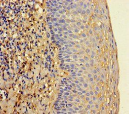 RNASEL Antibody