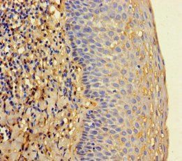 2-5A-dependent ribonuclease antibody