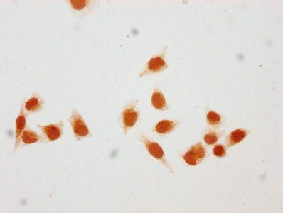 HIST1H1C Antibody