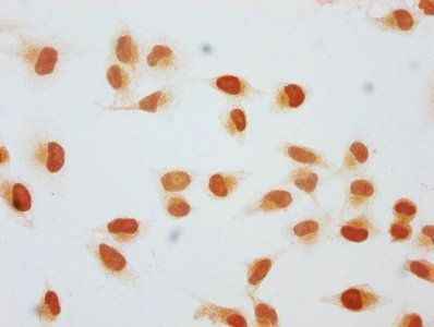 HIST1H1C Antibody