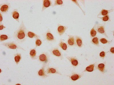 HIST1H1C Antibody
