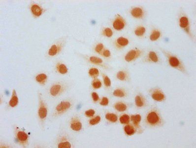 HIST1H1C Antibody