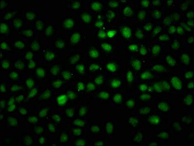 HIST1H1C Antibody