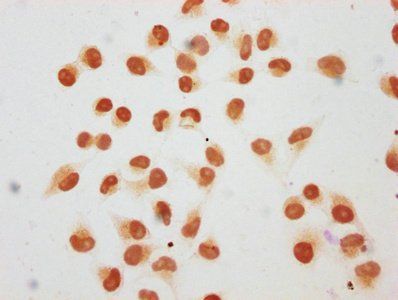 HIST1H1C Antibody