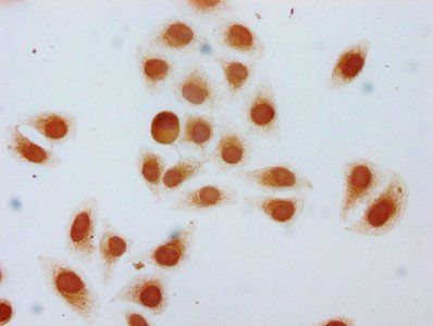 HIST1H1C Antibody