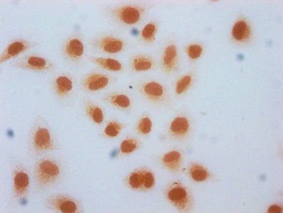 HIST1H2AG Antibody