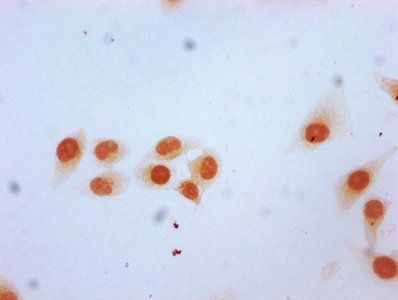 HIST1H2BC Antibody