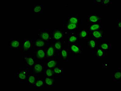 HIST1H2BC Antibody