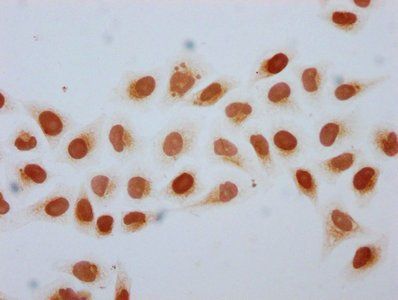 HIST1H2BC Antibody