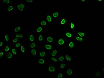 HIST1H2BC Antibody