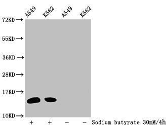 HIST1H2BC Antibody