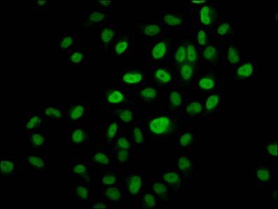 2-hydroxyisobutyryl-HIST1H3A (K14) Antibody