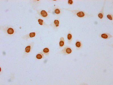 2-hydroxyisobutyryl-HIST1H3A (K18) Antibody