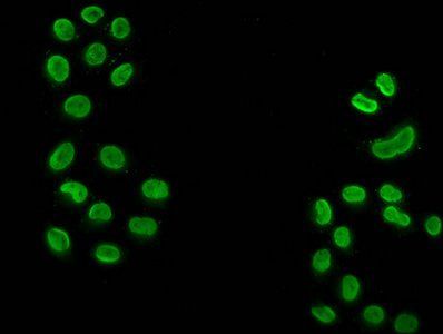 2-hydroxyisobutyryl-HIST1H3A (K18) Antibody