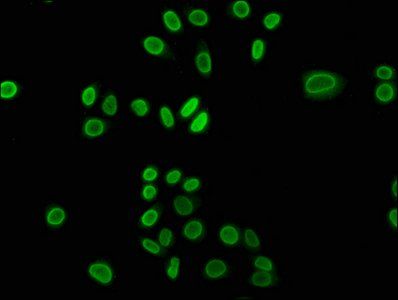 2-hydroxyisobutyryl-HIST1H3A (K23) Antibody
