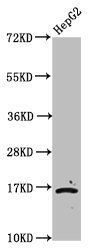 2-hydroxyisobutyryl-HIST1H3A (K23) Antibody