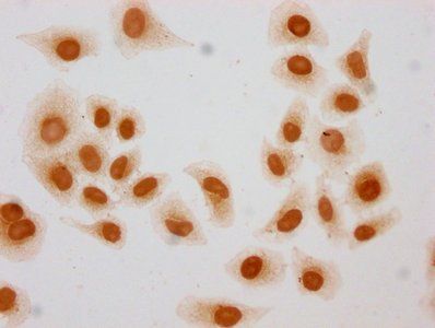 2-hydroxyisobutyryl-HIST1H3A (K27) Antibody