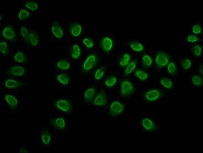 2-hydroxyisobutyryl-HIST1H3A (K27) Antibody