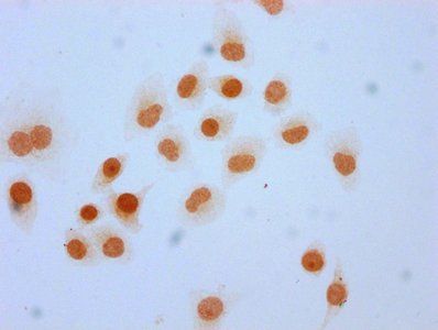 2-hydroxyisobutyryl-HIST1H3A (K4) Antibody