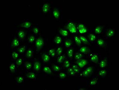 2-hydroxyisobutyryl-HIST1H3A (K4) Antibody