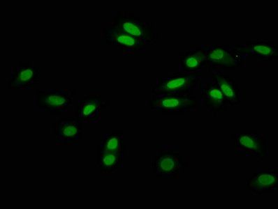 2-hydroxyisobutyryl-HIST1H3A (K56) Antibody