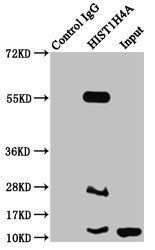 2-hydroxyisobutyryl-HIST1H4A (K16) antibody