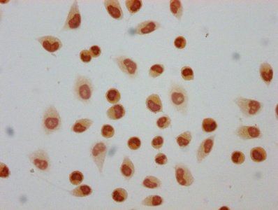 HIST1H4A Antibody