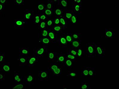 HIST1H4A Antibody