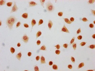 HIST1H4A Antibody