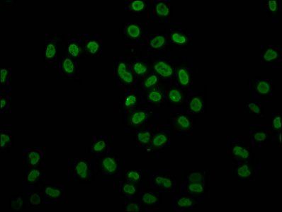 HIST1H4A Antibody