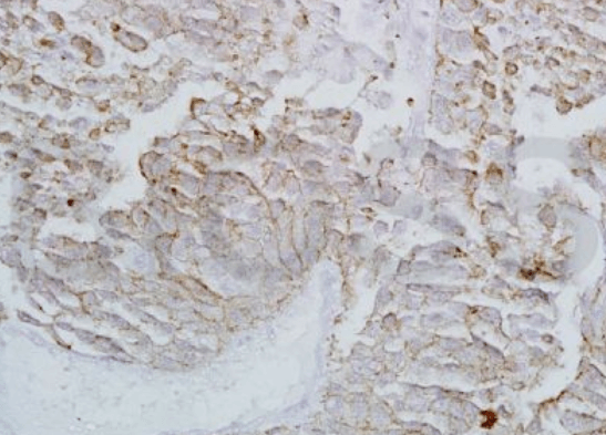 SLC34A2 Rabbit Polyclonal Antibody