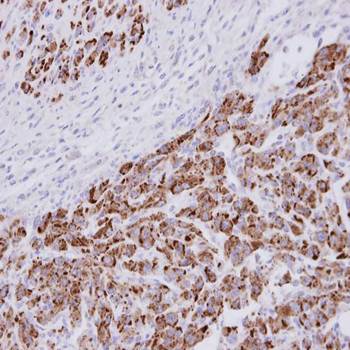 20S Proteasome alpha3 antibody