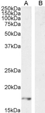 VEGFA (aa387-399) Antibody