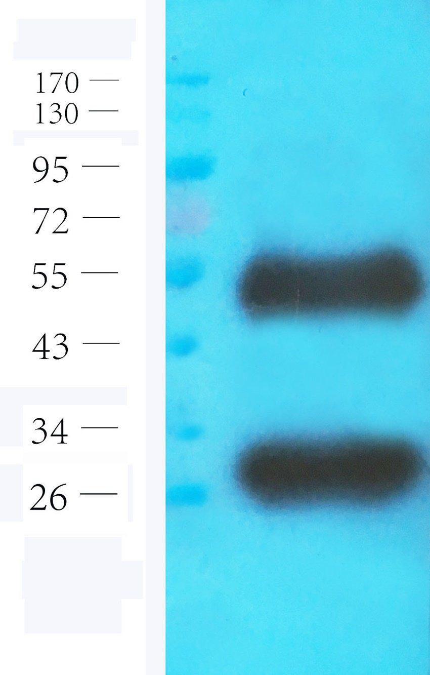 ICAM1 antibody