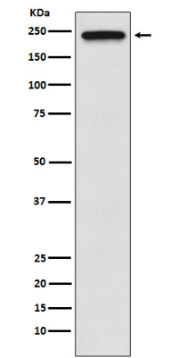 TRPM7 Rabbit Monoclonal Antibody