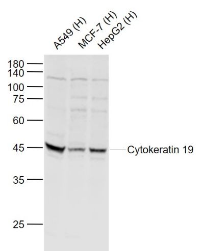 CK19 antibody (FITC)