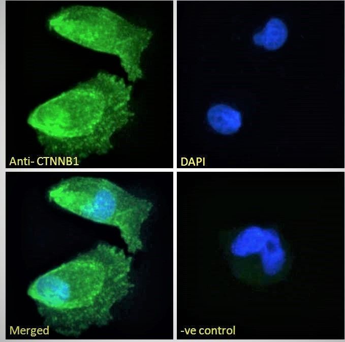 CTNNB1 antibody