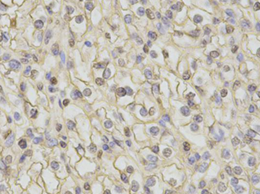 CAMK4 Antibody