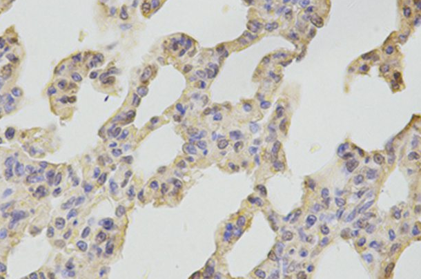 CAMK4 Antibody