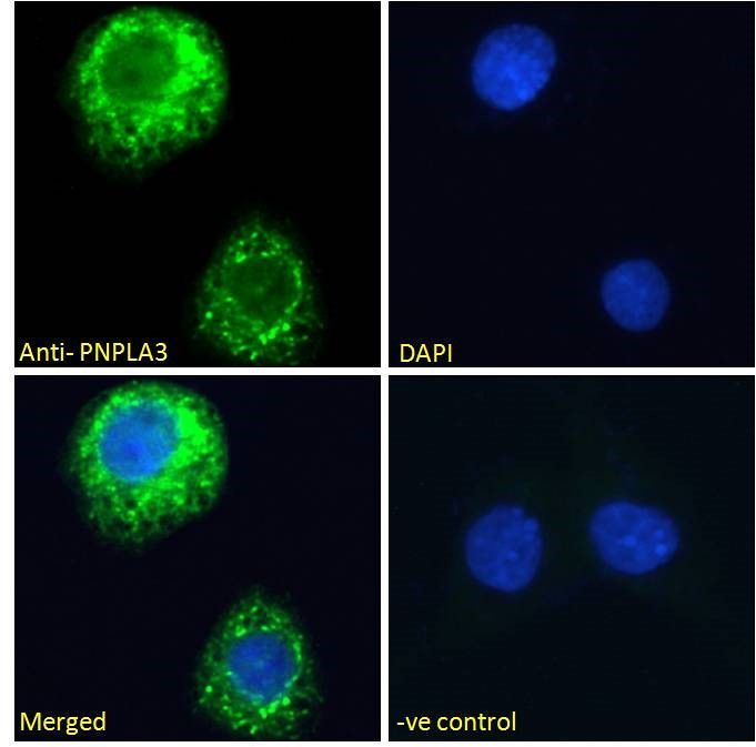 PNPLA3 antibody