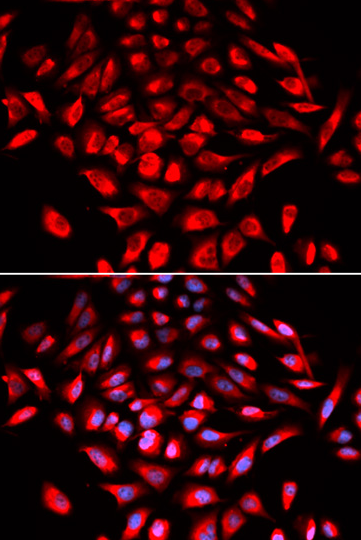 CAMK4 Antibody