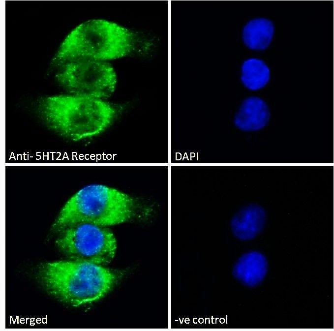 5-HT2A Receptor antibody