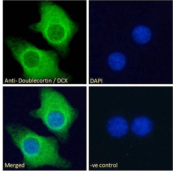 Goat anti-Doublecortin / DCX (aa232-242) Antibody