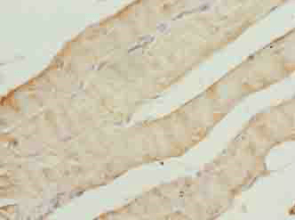 CAP2 Antibody