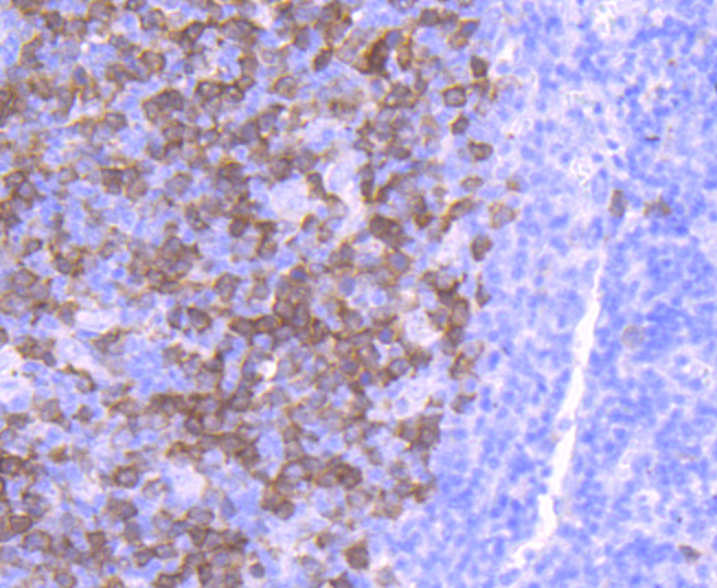 Thymidine Kinase 1 Antibody