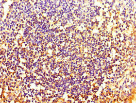 HOXA2 Antibody